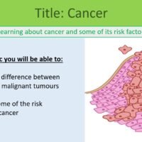 GCSE Biology Topic 2 Organisation: Cancer Lesson Objectives