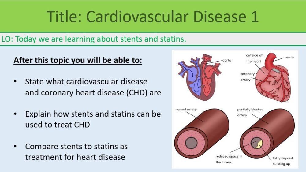 Cardiovascular Disease I Preview of Lesson Objectives for Cardiovascular Disease lesson 2
