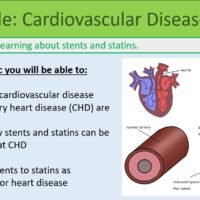 Cardiovascular Disease I Preview of Lesson Objectives for Cardiovascular Disease lesson 2