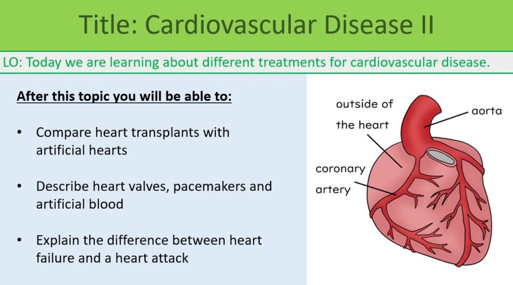 Cardiovascular Disease II Preview of Lesson Objectives for Cardiovascular Disease lesson 1