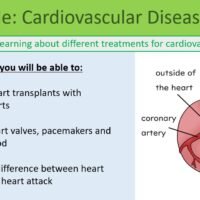 Cardiovascular Disease II Preview of Lesson Objectives for Cardiovascular Disease lesson 1