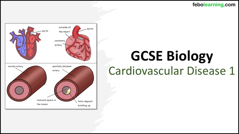 Cardiovascular Disease Part 1 GCSE Biology TITLE Title Slide: GCSE Biology Topic 2 Organisation: Cardiovascular Disease Part 1