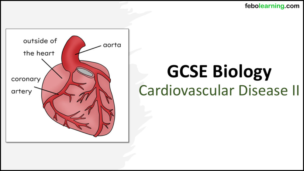 Cardiovascular Disease Part 2 GCSE Biology TITLE Title Slide: GCSE Biology Topic 2 Organisation: Cardiovascular Disease Part 2