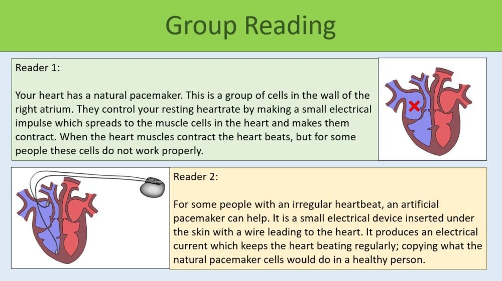 Cardiovascular Disease Reading Preview of Group Reading Task for Cardiovascular Disease lesson