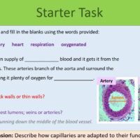 Cardiovascular Disease Starter Preview of Starter Task for Cardiovascular Disease lesson