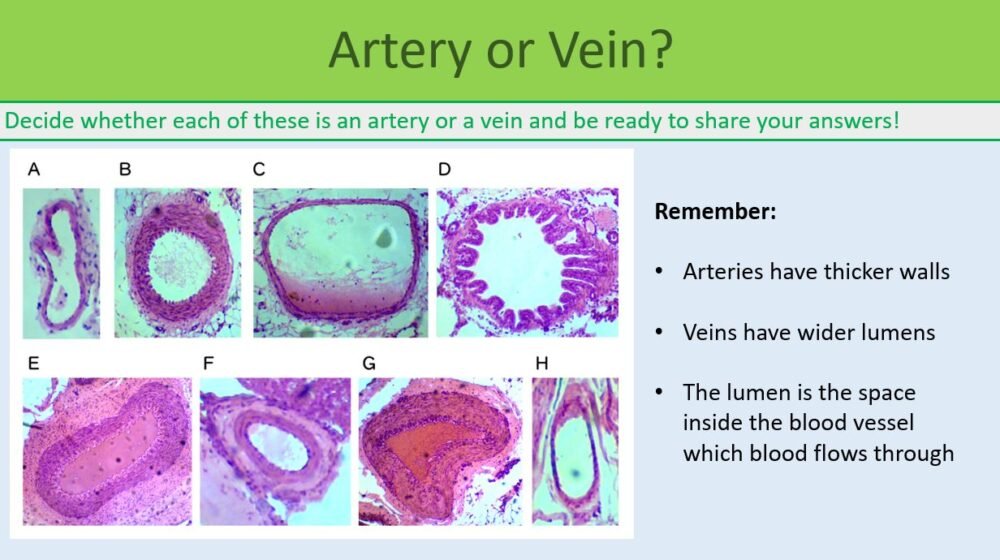 Circulatory System Artery or Vein GCSE Biology Circulatory System Artery or vein slide