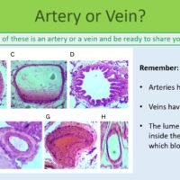 Circulatory System Artery or Vein GCSE Biology Circulatory System Artery or vein slide