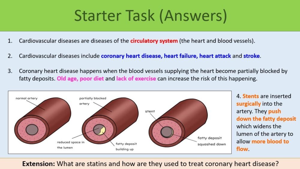 Preview of Starter Task for GCSE Biology Topic 2 Organisation: Risk Factors