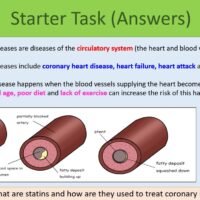 Preview of Starter Task for GCSE Biology Topic 2 Organisation: Risk Factors