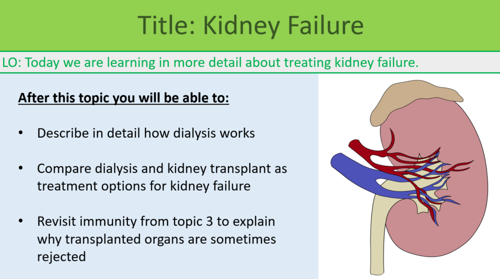 GCSE Biology Topic 5: Kidney Failure Lesson Objectives