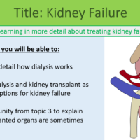 GCSE Biology Topic 5: Kidney Failure Lesson Objectives
