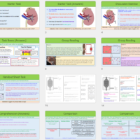 GCSE Biology Topic 5: Kidney Failure Lesson slide thumbnails