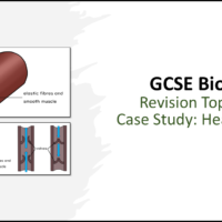 GCSE Biology BONUS Revision Topics 1-4 Heart Failure Case Study Title Slide