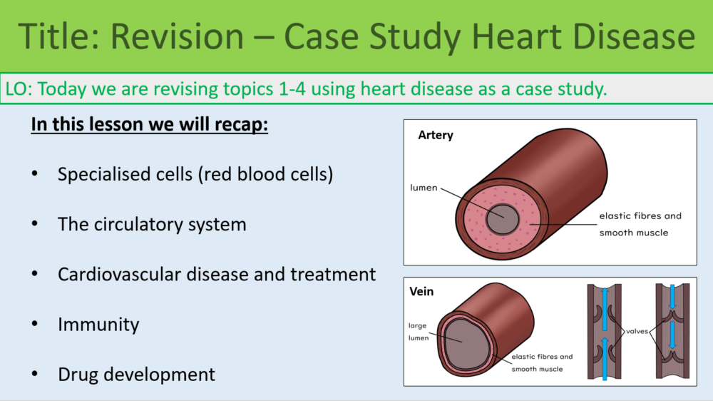 GCSE Biology Topic 1-4: Revision Heart Disease Case Study Learning Objectives Slide Preview