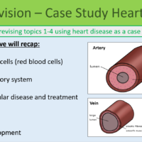 GCSE Biology Topic 1-4: Revision Heart Disease Case Study Learning Objectives Slide Preview