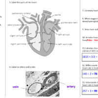 Revision Heart Case Study Worksheet