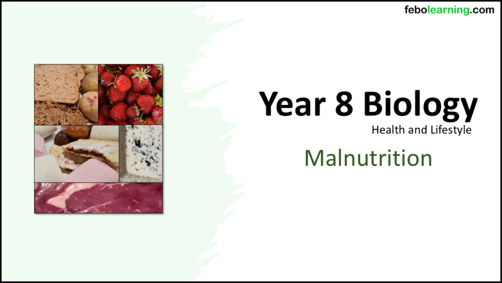 Year-8 Biology Health and Lifestyle Malnutrition Title